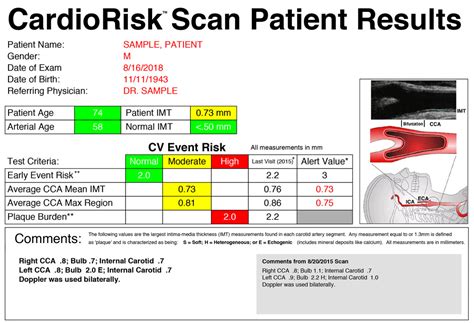 plaque scan carotid intima-media thickness testing or cimt|carotid artery thickness test.